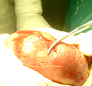 �I��ֲ���g